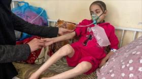 21 niños mueren en Gaza por “desnutrición y hambre” en 72 horas