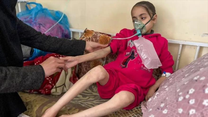 21 niños mueren en Gaza por “desnutrición y hambre” en 72 horas | HISPANTV