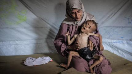 “La dieta de Gaza, ayuno obligatorio cortesía del régimen israelí”