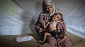 “La dieta de Gaza, ayuno obligatorio cortesía del régimen israelí”