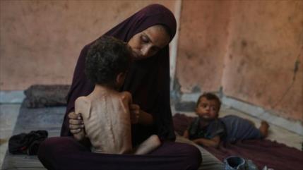 Gaza sufre récord histórico de desnutrición infantil, alerta la OMS