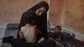 Gaza sufre récord histórico de desnutrición infantil, alerta la OMS