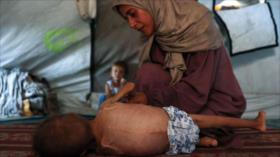 Jefe de ONU avisa: palabras no alimentan a niños hambrientos en Gaza