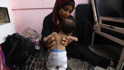 Gaza enfrenta inminente muerte de 100 000 niños por bloqueo israelí