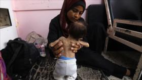 Gaza enfrenta inminente muerte de 100 000 niños por bloqueo israelí