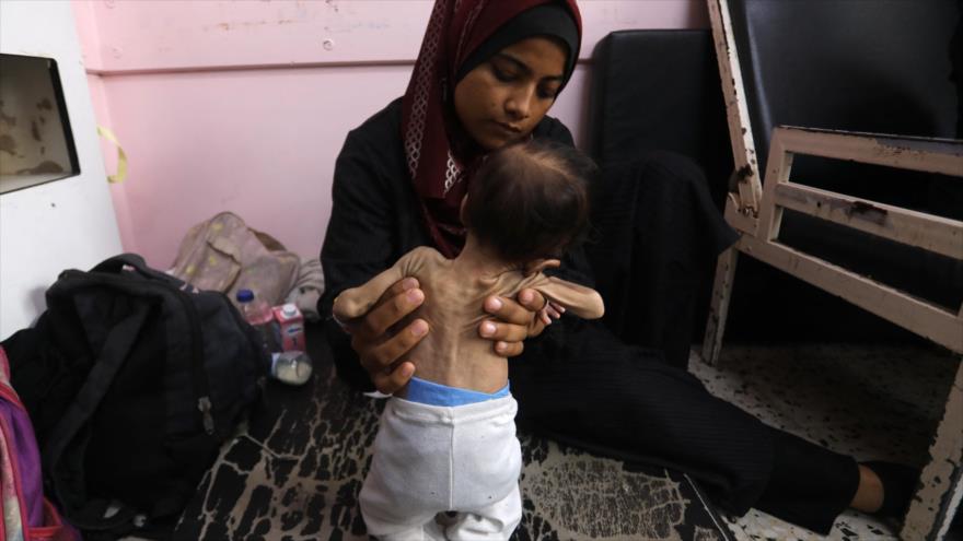 Yasmine, una madre palestina de 22 años, sostiene en brazos a su hija Teen, de dos meses, desnutrida, en el Hospital Naser de Jan Yunes. (Foto: AFP)