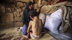 HAMAS: Negociar es desacierto mientras Israel mata de hambre a gazatíes