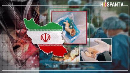 Irán, entre 10 mayores productores de válvulas biológicas en mundo