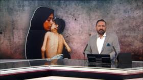 Israel continúa con sus crímenes imperdonables contra Gaza – Noticiero 13:30