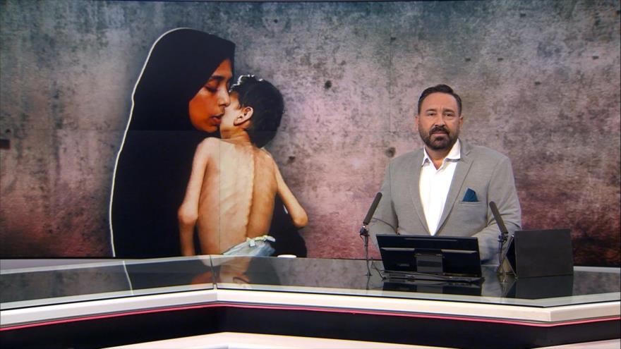 Israel continúa con sus crímenes imperdonables contra Gaza – Noticiero 13:30