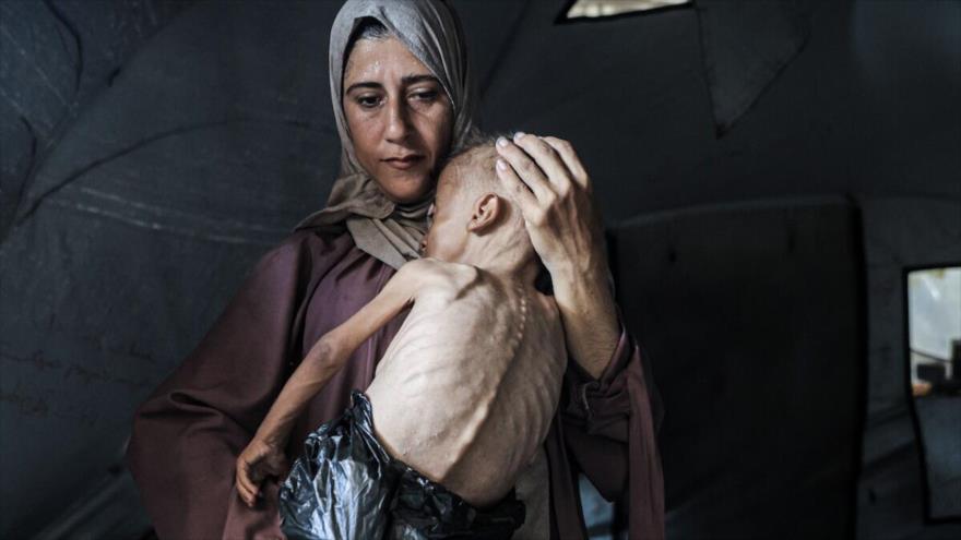 Muhamad Zakariya Ayyub al-Matouq, un niño de 18 meses en Gaza que enfrenta una desnutrición potencialmente mortal.