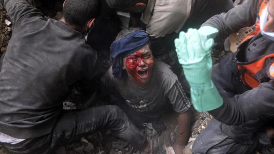 Un niño palestino lesionado llora mientras rescatistas intentan sacarlo de los escombros de un edificio destruido después de un ataque israelí en la Franja de Gaza. (Foto: AP)