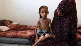 ONU: Un millón de mujeres y niñas en Gaza sufren hambre extrema