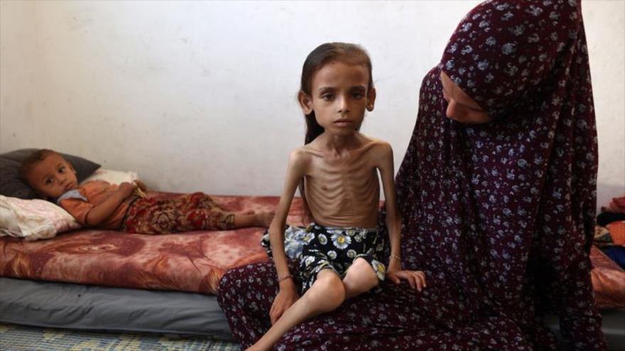 oto: Una niña palestina desnutrida sentada en el suelo junto a su madre en el barrio de Rimal, ciudad de Gaza, el 2 de agosto de 2025. (FOTO: AFP)