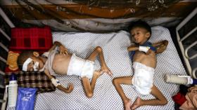 ONU lamenta “intolerables imágenes” de palestinos muriendo de hambre
