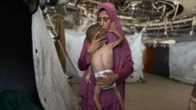 Otros 5 palestinos, incluidos 2 niños, mueren en Gaza por inanición
