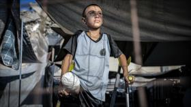 Euro-Med: 30 palestinos quedan discapacitados cada día en Gaza
