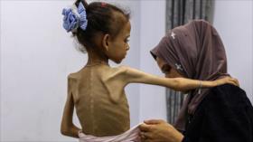 ONU declarará oficialmente hambruna en Gaza por 1.ª vez
