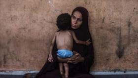 UNICEF avisa sobre inminente muerte de 450 000 niños en Gaza