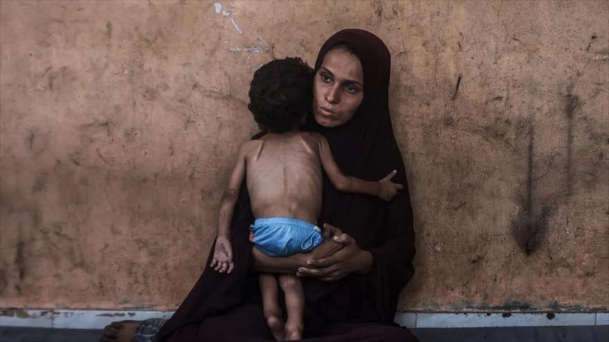 Una madre palestina sostiene a su hijo afectado por la desnutrición tras asedio israelí en la Franja de Gaza.