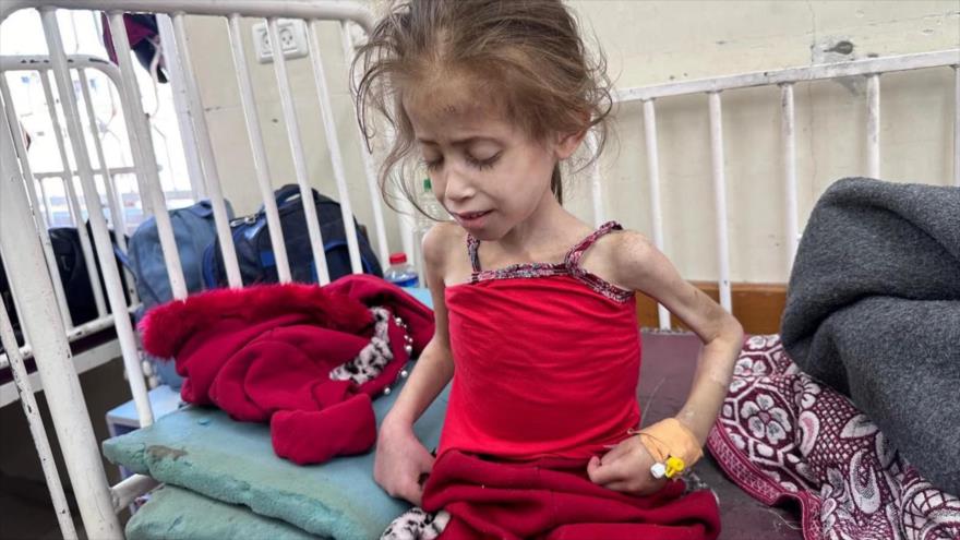 Una niña palestina que sufre de la hambruna en Gaza se encuentra ingresada en el hospital Kamal Adwan.