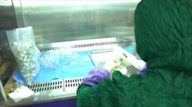 Tejidos Trasplantados, Recuperación Natural | Iran Tech