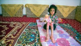  Irán tacha de “inhumanas” sanciones de EEUU contra pacientes con EB