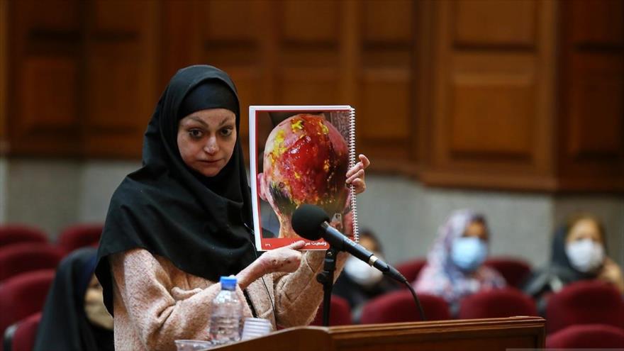 Pacientes con la epidermólisis bullosa (EB), atendidos en el Tribunal de Relaciones Internacionales de Teherán, para denunciar efectos de sanciones de EE.UU.