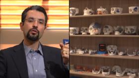Reconstruyendo rostros: implantes de titanio - Iran Tech