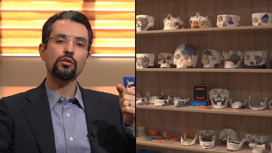 Reconstruyendo rostros: implantes de titanio - Iran Tech