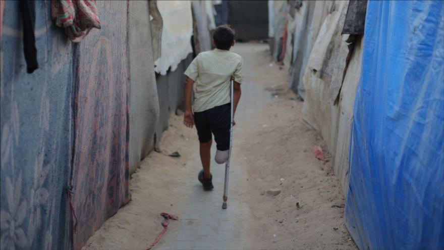 Un niño palestino con una pierna lesionada camina entre tiendas de campaña, apoyándose en su bastón. (Foto: Anadolu)