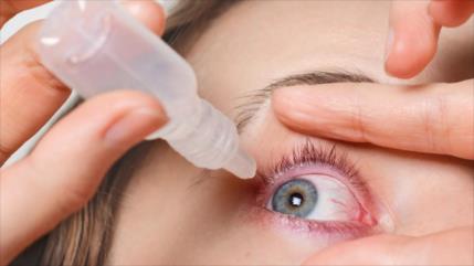 ¿Por qué el ojo seco afecta a más personas y cómo prevenirlo?