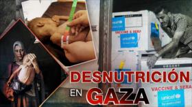 Unicef alerta sobre 9300 bebés en Gaza amenazados por desnutrición aguda | Detrás de la Razón