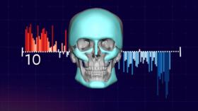 El futuro de la cirugía maxilofacial | Iran Tech