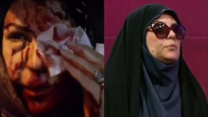 Periodista iraní relata cómo resultó herida por disparo de terroristas