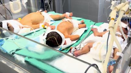 Crecen malformaciones en recién nacidos por el colapso sanitario en Gaza
