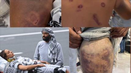 ONU denuncia abusos contra activistas de Sumud y exige cuentas a Israel