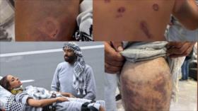 ONU denuncia abusos contra activistas de Sumud y exige cuentas a Israel