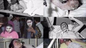 Irán reietera su exigencia de justicia por el ataque químico de Sardasht