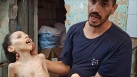 Niña palestina muere por crisis de hambre impuesta por Israel en Gaza