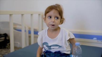 Gaza: niños sufren malnutrición en medio de la crisis alimentaria