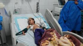 Exfuncionario y congresista de EEUU: Nuestras bombas matan a civiles en Irán