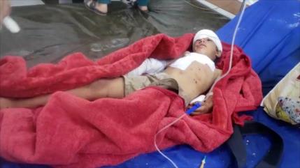 Arabia Saudí mata a 3 niños y hiere a 17 con bombas prohibidas en Yemen