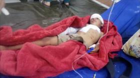 Ataques saudíes contra Yemen dejan 3 niños muertos y 17 civiles heridos